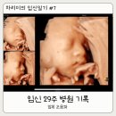 주수의과 병원 | 차리미의 임신일기 #7_[임신 29주] 임신 후 병원 진료 기록 (초음파 용어정리 /입체 초음파 실패)