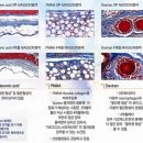 웰빙비뇨기과 네이버블로그