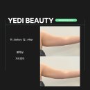 예디뷰티