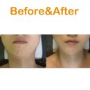 브니엘 | 아산피부관리 브니엘에스테틱 윤곽관리 후기