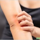 포낙보청기 대구센터 이미지