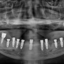 가이드치과기공소 이미지