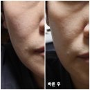 ㈜그린메디 | [영양크림추천]메디퓨린 트웬티 루멘 셀 크림 체험 후기
