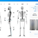 하은메디컬 네이버블로그