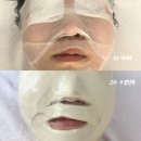 브레인 바둑(1-2) | 거제동피부관리 &#34;박소현에스테틱&#34; 디브레인 수분 부스팅 후기 🌿