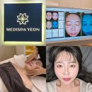 길 메디스 | 기흥역피부관리 &amp; 용인웨딩관리 메디스파연에서 얼굴 작아진 후기