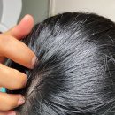 양미경헤어라인 | 두피 자생앰플 추천, 4주 사용해본 리필드 엑소좀 앰플 2차 후기
