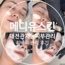 1569 | 대전 관저동 피부관리 샵 메디유스킨 리베룩 관리 후기