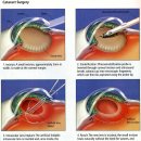 참밝은안과의원 이미지