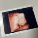 김천의료원 | 김천의료원 태동검사 입체초음파 후기