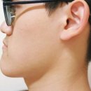 설악의원 | 스플린트 개방교합 일기. 교정 후 얼굴형 변화 후기