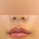 르에이치의원 이미지