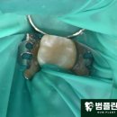 범플란트치과의원