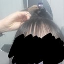 해운대 피부과 #준의원 30대여성 탈모 극복 4개월 후기