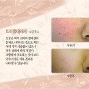 피브로한의원 이미지