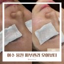웅천디아일랜드 | 여수 피부관리 오이뷰티 트러블 모공 케어 1:1 맞춤 관리 굿