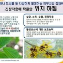 볼륨테라피 이미지
