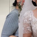 (주)조이핀 | 안양범계평촌 팔뚝 지방분해주사 5주차 성공적 결혼식 후기