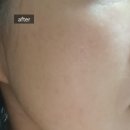 알로에피부연구소 이미지