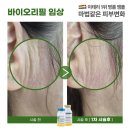 바이오헤드 이미지