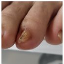 닥터아이티엔_로다살롱
