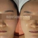 최성희SB발란스앤라인 이미지