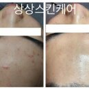 상상스킨케어 이미지