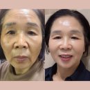 거꾸로 나이 인셀덤