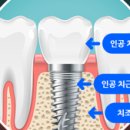 서울이수플란트치과의원