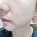 더에스테오 | 에스테오 플라즈마 수소 미스트 수소수 미스트로 피부관리해요.
