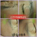 볼륨테라피 이미지