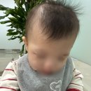헬맷2 | 아기 사두증 단두증 교정헬멧 착용 2개월 차 후기(+실제 수치 변화, 에이스밴드 교정헬멧)