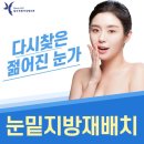 한미성형외과의원 | 압구정동눈밑성형외과 자연스러운 변화 원한다면 체크