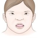 지적 장애[intellectual disability] 이미지
