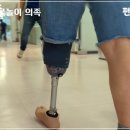 경기 의수족 보조기 이미지