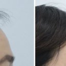 리프업의원 이미지