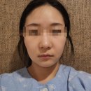 밸런스성형외과의원 | 신사역성형외과 리본성형외과 실리프팅 내돈내산