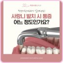 아산사랑니 제거 하기 전 살펴볼 부분은?