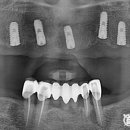 서울하이탑치과의원 이미지