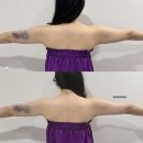 오앤리 스킨엔헤드스파 파주점 | 파주에스테틱_[오앤리스킨앤헤드스파 파주점] 팔 관리 후기