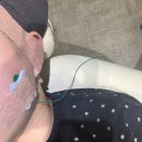 고랑포길 | 의정부 피부과 눈밑지 후기 당일부터 현재까지의 변화 기록