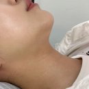 제이띠크 | 대구 달서구 피부관리샵 l ‘제이띠끄’ 스킨플래닝, 스킨미라클로 피부 톤업 후기(feat. 화이트태닝)