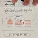 [마곡] 마곡색소관리 | 움트다 에스테틱 마곡본점 | 플라즈마 마곡피부관리 후기