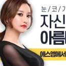 에스엠성형외과 이미지