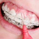 중앙플란트치과의원 이미지