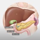 간으로 전이 된 암의 새로운 치료 방법 이미지