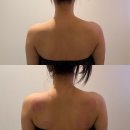 s-1 | 부천바디관리 수앤수뷰띠끄 S핏 관리로 1회만에 슬림해진 후기