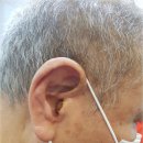 포낙보청기 대구센터 이미지