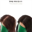 피부앤두피아카데미 | 나만 알고 싶은 춘천두피관리 더채움 스칼프 앤 뷰티, 만족도 먼저 생각한다면 꼭 알아야 할 이유