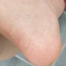프롬지 | 발각질제거 비누 프롬지 사용후기